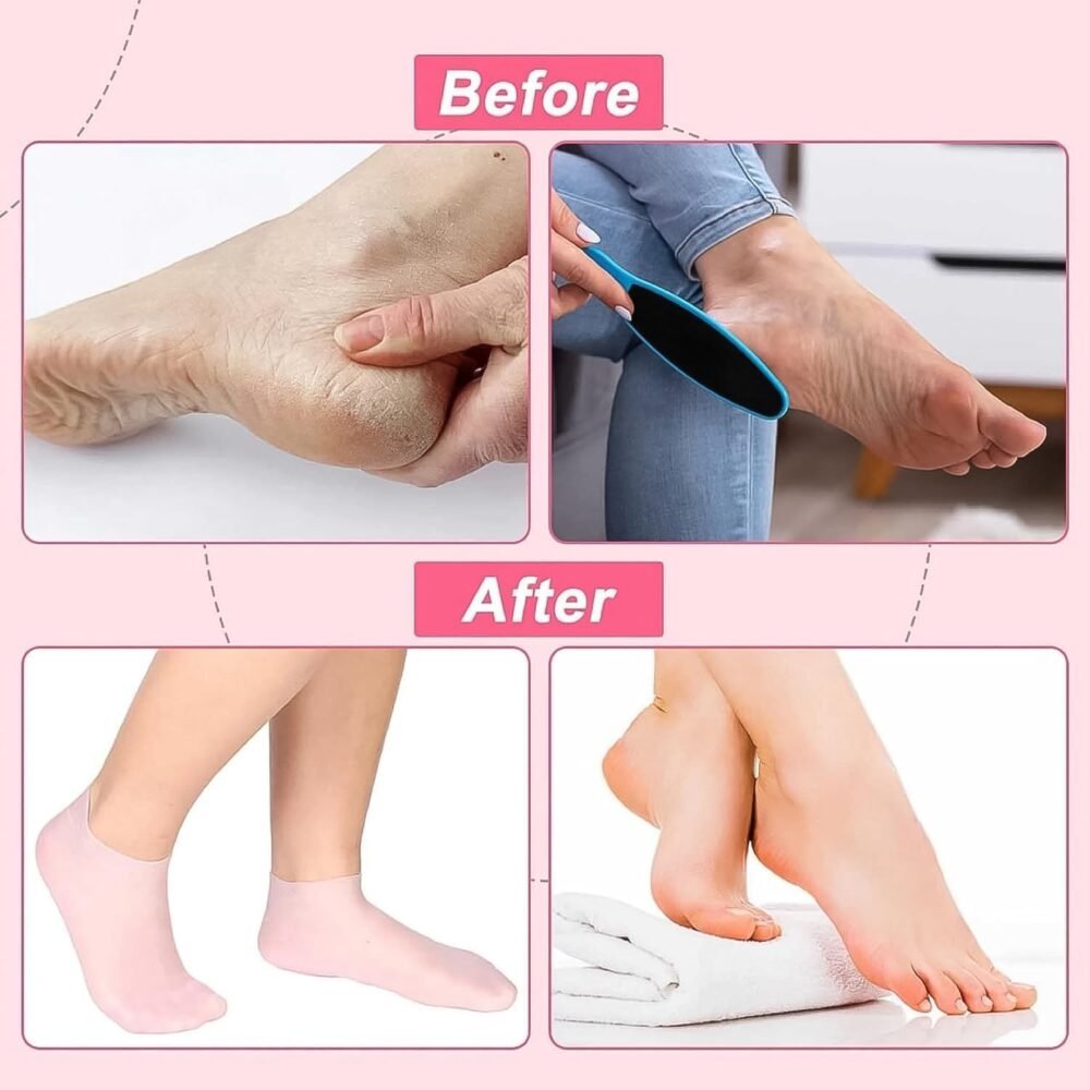 03_65e926f8-6717-4381-9280-ad33af0fb06e.jpg Silicone Moisturizing Socks – Softening Dry Cracked Feet