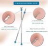 04_d440434a-24be-4407-8353-168de8f2f1eb.jpg Blackhead Remover Tool – 4-in-1 Stainless Steel Extractor | ToolMate Pro
