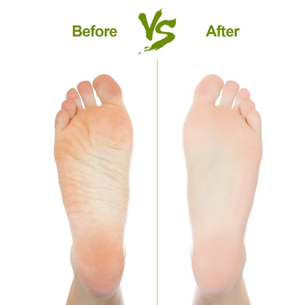 Foot Pumice Stone – Rectangular Dead Skin & Callus Remover